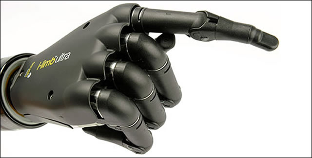 Touch Bionics- i-LIMB